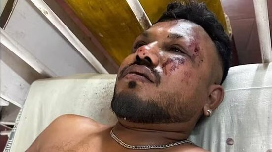 Sobrevivente de queda de avião na Índia, Vishwash Kumar Ramesh, um britânico-indiano que mora em Londres e estava em Ahmedabad visitando a família - Reprodução / Redes sociais